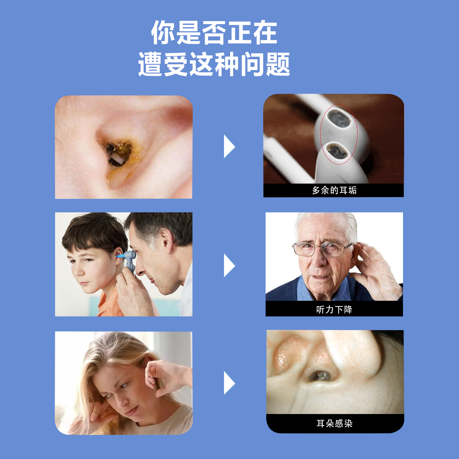 YY10 智能可视采耳器